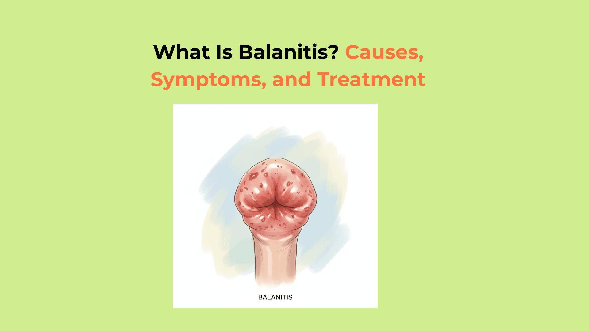 What Is Balanitis? A Complete Guide to Causes, Symptoms, and Treatment