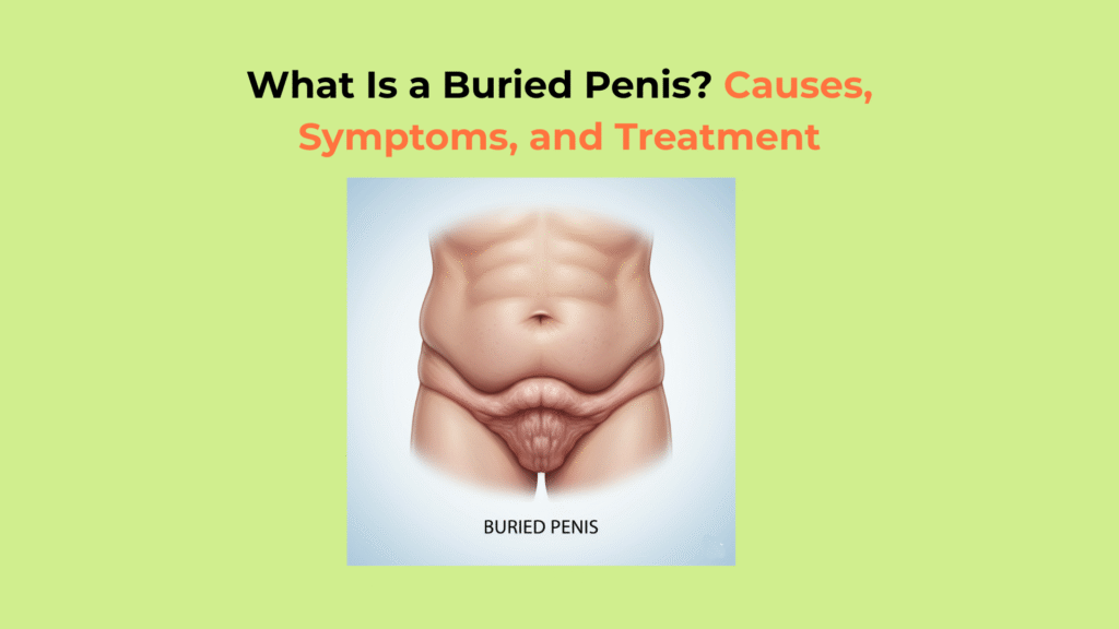 What Is a Buried Penis Causes Symptoms and Treatment