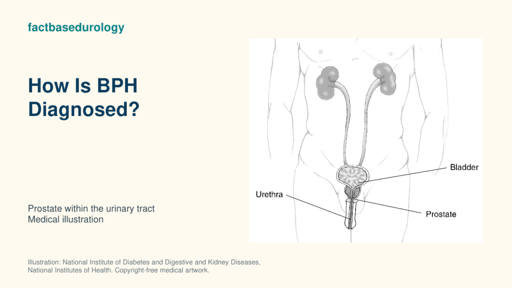 How Is BPH Diagnosed? — prostate within the urinary tract (medical illustration).