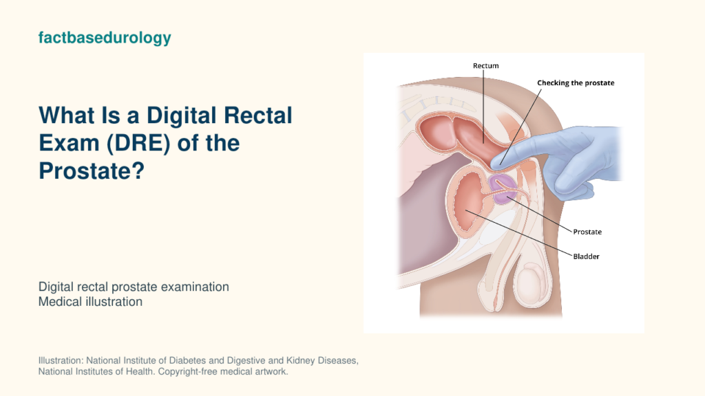 What Is a Digital Rectal Exam (DRE) of the Prostate? — digital rectal prostate examination (medical illustration).