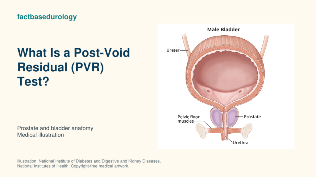 What Is a Post-Void Residual (PVR) Test? — prostate and bladder anatomy (medical illustration).