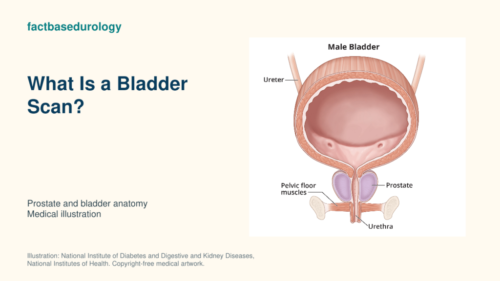 What Is a Bladder Scan? — prostate and bladder anatomy (medical illustration).