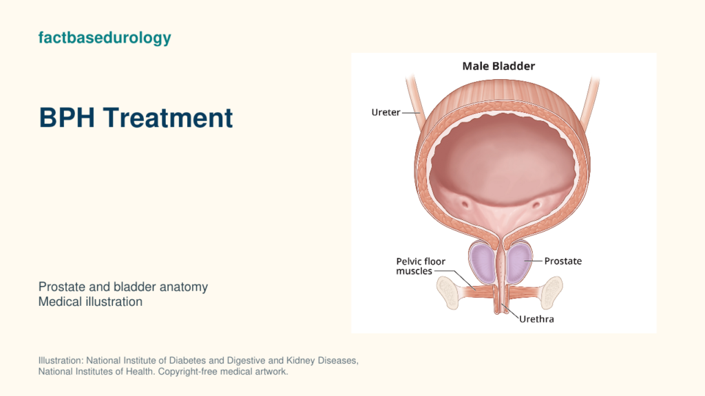 BPH Treatment — prostate and bladder anatomy (medical illustration).