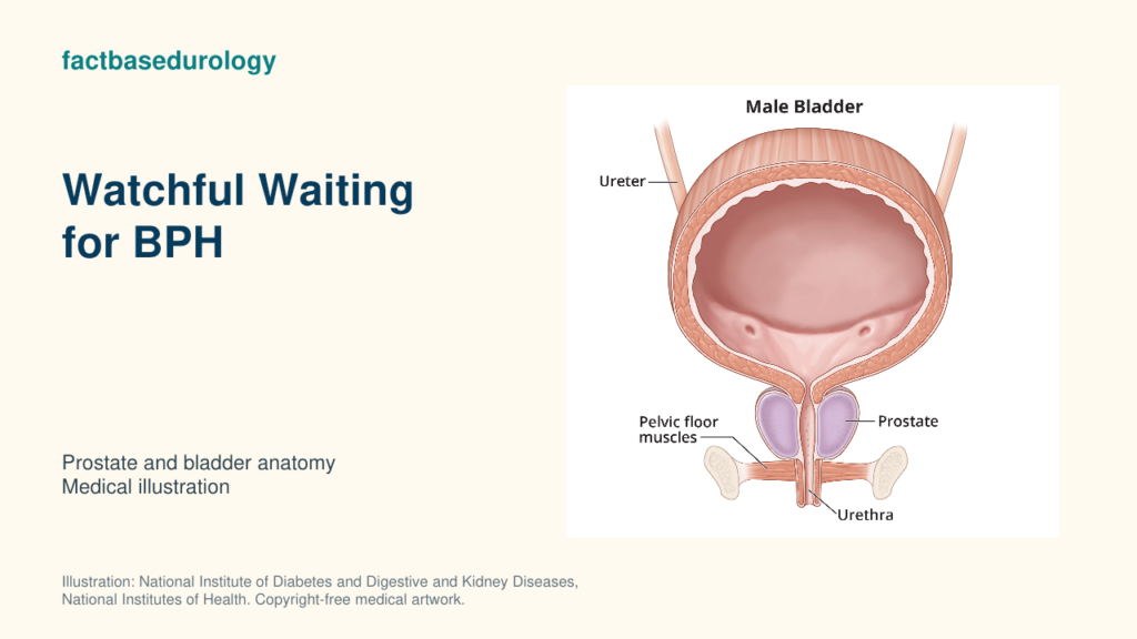 Watchful Waiting for BPH — prostate and bladder anatomy (medical illustration).