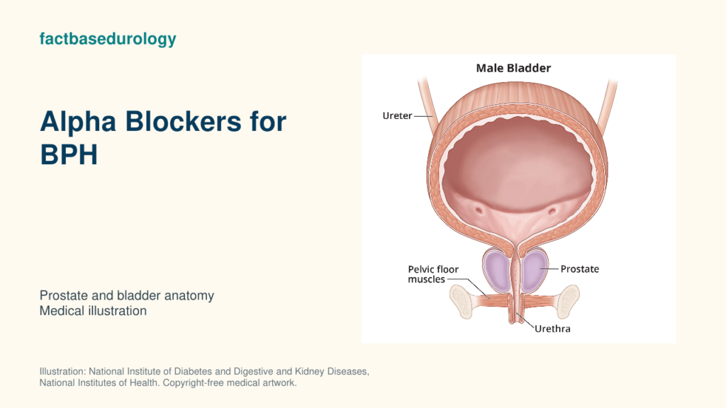 Alpha Blockers for BPH — prostate and bladder anatomy (medical illustration).