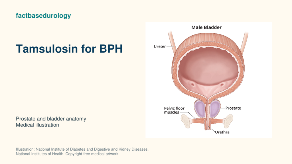 Tamsulosin for BPH — prostate and bladder anatomy (medical illustration).