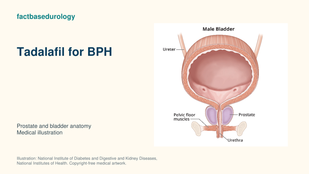 Tadalafil for BPH — prostate and bladder anatomy (medical illustration).