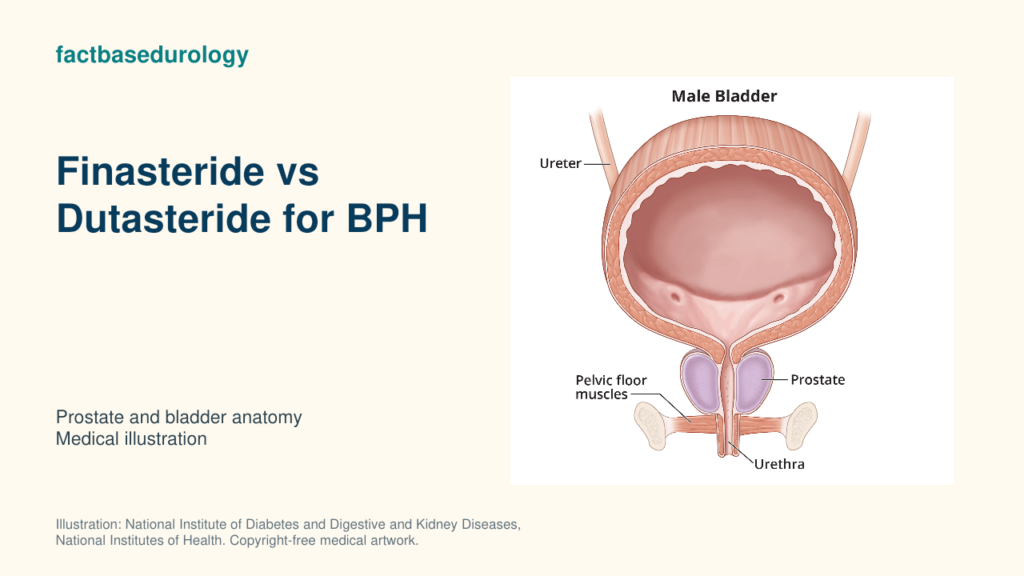 Finasteride vs Dutasteride for BPH — prostate and bladder anatomy (medical illustration).
