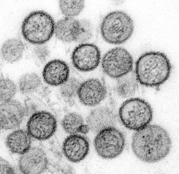 Can Hantavirus Shrink Your Penis? 1 Electron micrograph of Sin Nombre hantavirus particles